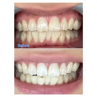 Ｍ渋谷 ホワイトニングのエステ・リラクイメージ