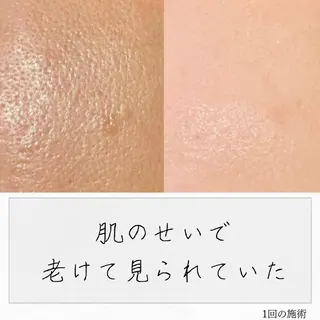 ニキビ経験者が施術 する専門サロン🌻のエステ・リラクイメージ