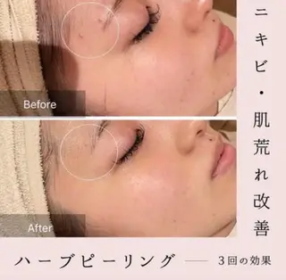 森 美優のエステ・リラクイメージ