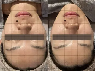 CHERIE Akaneのエステ・リラクイメージ