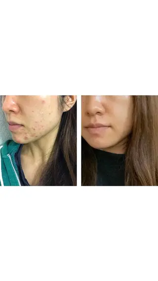 肩首こり×痩身×浄化 🌿リンパエステのエステ・リラクイメージ