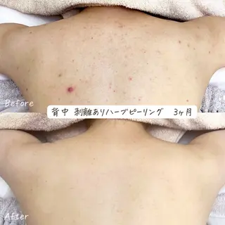 肌質改善サロン renew/ｳｴｷのエステ・リラクイメージ