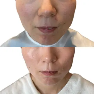 おかま直伝よもぎ蒸し 【aju】山本 亜樹のエステ・リラクイメージ