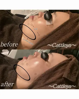 Cattleya 中目黒のエステ・リラクイメージ