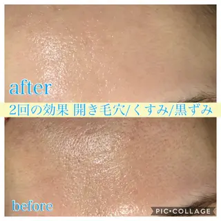 ロング カラー パーマ ヘアアレンジ メンズ ネイル マツエク・マツパ Ensor Clair所属・EnsorClair 代表 野口真央のエステ・リラクイメージ