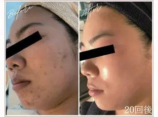 MYubelle ミューベルのエステ・リラクイメージ