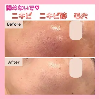 三沢市エステサロン Sブランペタルのエステ・リラクイメージ