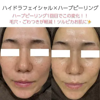 vary  clue MISAのその他イメージ