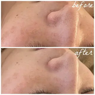 メンズ メナード岐阜市茜部 杉浦のエステ・リラクイメージ