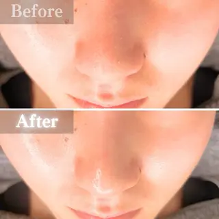 毛穴洗浄特化🫧 オオツカのエステ・リラクイメージ