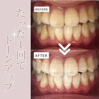 LIBRA自由が丘 ホワイトニングのその他イメージ