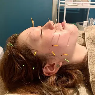 池袋美容鍼サロン ヴィクトワール　小林のエステ・リラクイメージ