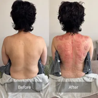 かっさ吸玉サロン Fluentのエステ・リラクイメージ