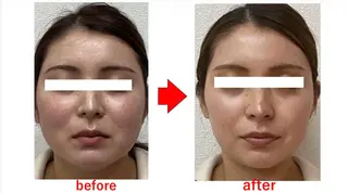 ブプラ 倉敷店のエステ・リラクイメージ