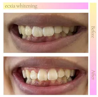 セルフホワイトニング エクシア武蔵小杉店のその他イメージ