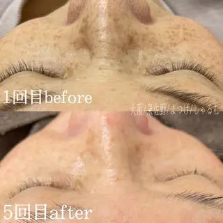 しゃるむ所属・しゃるむ 🍀のエステ・リラクイメージ