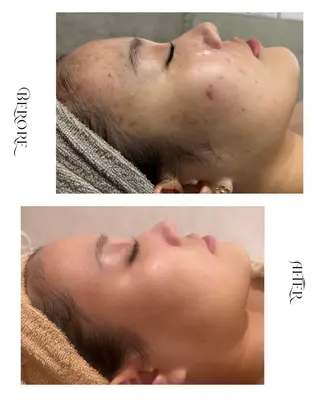 脱毛・肌質改善サロン Linoのエステ・リラクイメージ