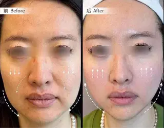 マツエク・マツパ aliaハーブ水光店 エステティシャン募集のエステ・リラクイメージ