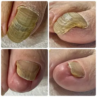 gorella Ａのネイルデザイン