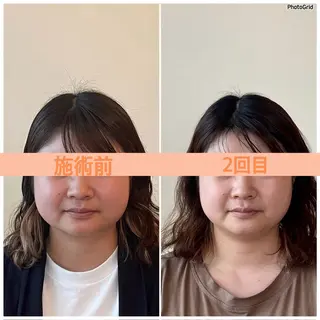 小顔矯正サロン　ReFace Fusae（リフェイスフサエ）所属・小顔矯正サロン リフェイスフサエのエステ・リラクイメージ