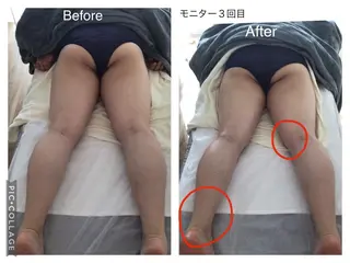 子宮矯正/腸揉み/ シュガーリング脱毛のエステ・リラクイメージ