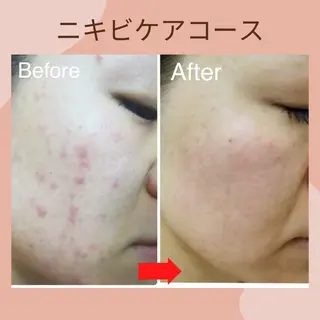 札幌ホワイトニング ラディアンス菊水店のその他イメージ