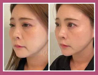 盛れる小顔矯正師 たく先生のエステ・リラクイメージ