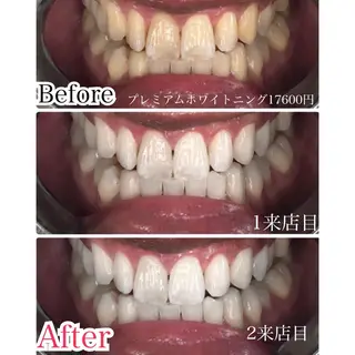 マツエク・マツパ プラチナムビューティー柏所属・【歯科提携】柏ホワイ トニングスタイルのその他イメージ