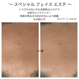 ビューティー ミロワールのエステ・リラクイメージ