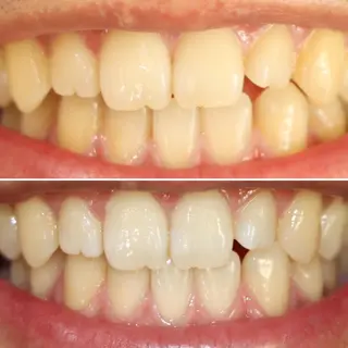 メンズアイリスト 黒崎 光俊のマツエク・マツパデザイン