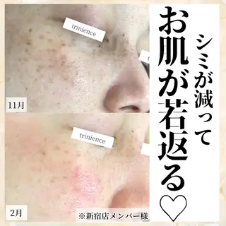 シミケア肌改善専門 トリニエンス新宿店のエステ・リラクイメージ