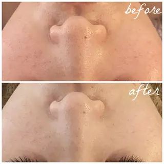 メンズ メナード岐阜市茜部 杉浦のエステ・リラクイメージ