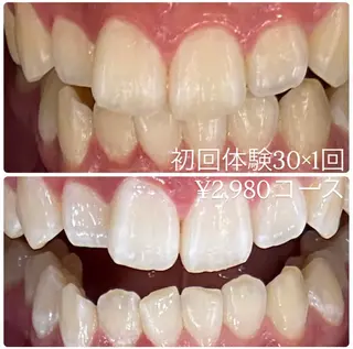 ホワイトニングルーム 横浜店のその他イメージ