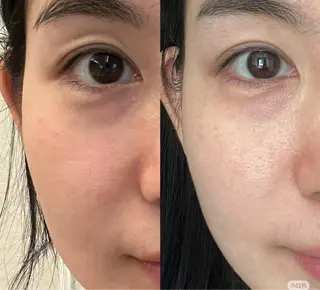 愛維美水光美肌専門店所属・愛維美水光美肌専門店 メンズレディースokのエステ・リラクイメージ