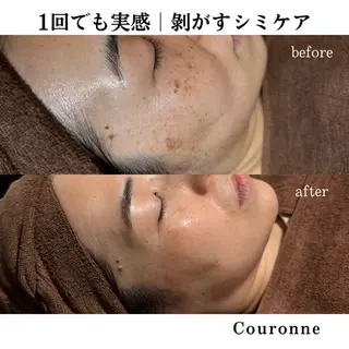 シミ・毛穴ケア専門 クロヌYUKIのエステ・リラクイメージ