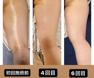 🌴Beauty Salon LANAのエステ・リラクイメージ