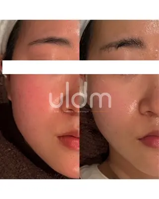 【韓国肌管理・脱毛】 クレセントのその他イメージ