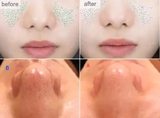 全身脱毛＆VIO脱毛 紹介率№1♪リナ♪のエステ・リラクイメージ