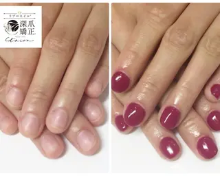 メンズ ネイル 深爪矯正専門店　ネイルサロン　トイロ所属・ネイルサロン トイロのネイルデザイン