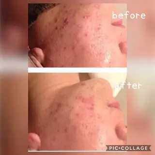 美肌蘇生カウンセラー 横山りえのエステ・リラクイメージ