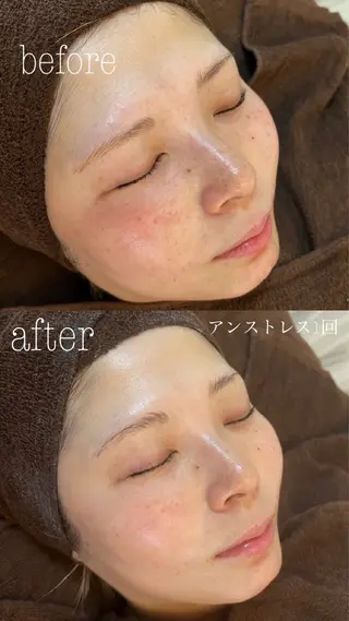 肌質改善|美眉サロン Cannone’のエステ・リラクイメージ