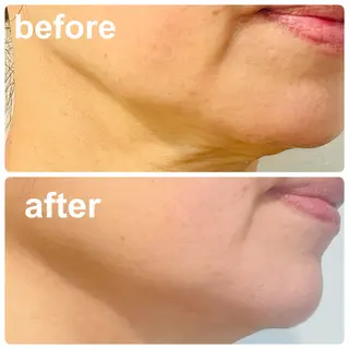 POLA 北花田店のエステ・リラクイメージ