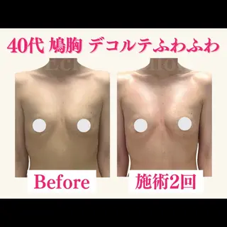 エクラパピヨン バストアップサロンのエステ・リラクイメージ