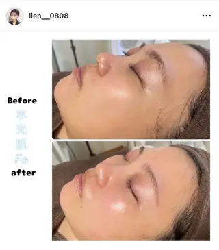 Lien~毛穴 専門サロンのその他イメージ