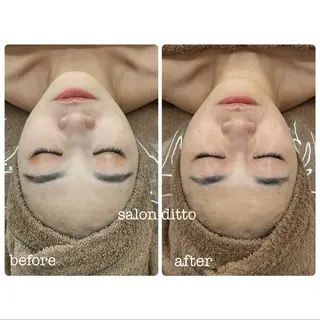 salon ditto所属・mio (小顔・ヘッドスパ)のエステ・リラクイメージ