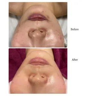 EYE LASH LAPISのエステ・リラクイメージ