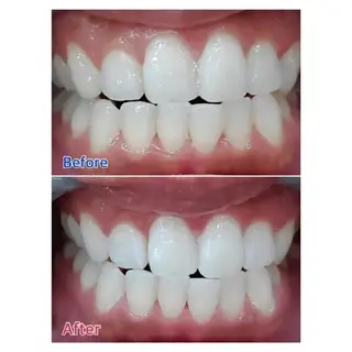 Ｍ渋谷 ホワイトニングのエステ・リラクイメージ