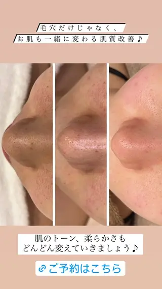 アイスリーサロン所属・毛穴改善サロン アイスリーのエステ・リラクイメージ