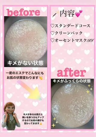 肌質改善サロン 来店プレゼントありのエステ・リラクイメージ