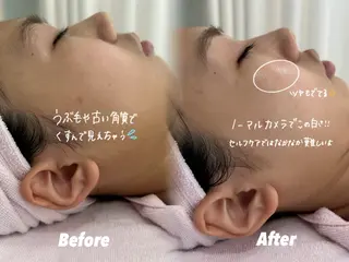 🫧美しい素肌へ🫧 今成柚乃のその他イメージ